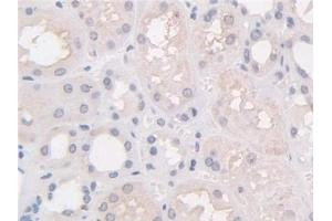 Detection of HPS4 in Human Kidney Tissue using Polyclonal Antibody to Hermansky Pudlak Syndrome Protein 4 (HPS4)
