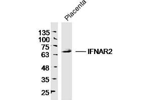Mouse Placenta lysates probed with IFNAR2 Polyclonal Antibody, unconjugated  at 1:300 overnight at 4°C followed by a conjugated secondary antibody at 1:10000 for 60 minutes at 37°C.