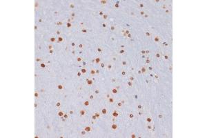 Immunohistochemistry of paraffin-embedded mouse brain using TriMethyl-Histone H3-K27 antibody (ABIN3023268, ABIN3023269, ABIN3023270, ABIN1513002 and ABIN6219521) at dilution of 1:100 (40x lens). (Histone 3 anticorps  (H3K27me))