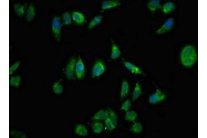 Immunofluorescent analysis of Hela cells using ABIN7161394 at dilution of 1:100 and Alexa Fluor 488-congugated AffiniPure Goat Anti-Rabbit IgG(H+L)