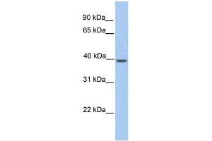 WB Suggested Anti-Klkbl4 Antibody Titration: 0. (PRSS54 anticorps  (C-Term))
