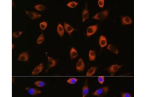 Immunofluorescence analysis of L929 cells using PPP1R9B Polyclonal Antibody at dilution of 1:100.