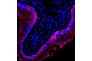 Immunofluorescence of paraffin embedded rat esophagus using CK13 (ABIN7074412) at dilution of 1:1500 (400x lens)