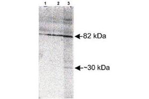 Western blot analysis of Scarb2 in Jurkat whole cell lysate with Scarb2 polyclonal antibody  at different concentration : Lane 1, 1 : 1000. (SCARB2 anticorps)