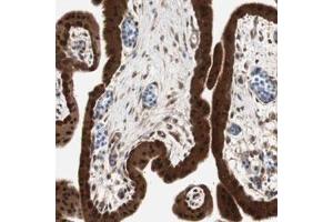 Immunohistochemical staining (Formalin-fixed paraffin-embedded sections) of human placenta with GALT polyclonal antibody  shows strong nuclear and cytoplasmic positivity in trophoblastic cells. (GALT anticorps)