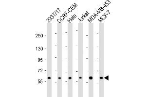 All lanes : Anti-RNF31 Antibody (C-term) at 1:2000 dilution Lane 1: 293T/17 whole cell lysate Lane 2: CCRF-CEM whole cell lysate Lane 3: Hela whole cell lysate Lane 4: Jurkat whole cell lysate Lane 5: MDA-MB-453 whole cell lysate Lane 6: MCF-7 whole cell lysate Lysates/proteins at 20 μg per lane.