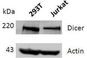 Western blot analysis of DICER expression in lysates of 293T and Jurkat cells.