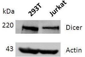 Western blot analysis of DICER expression in lysates of 293T and Jurkat cells. (DICER1 anticorps  (full length))