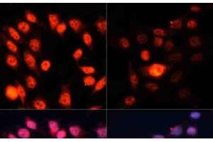 Immunofluorescence analysis of HeLa cells using Phospho-P70 S6K(T389) Polyclonal Antibody at dilution of 1:100.