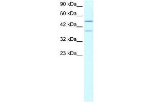 WB Suggested Anti-USP3 Antibody Titration:  0. (USP3 anticorps  (N-Term))