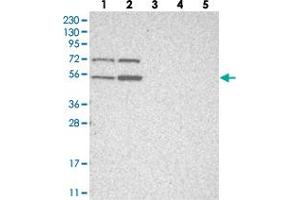 Western blot analysis of Lane 1: RT-4, Lane 2: U-251 MG, Lane 3: Human Plasma, Lane 4: Liver, Lane 5: Tonsil with ZNF642 polyclonal antibody  at 1:250-1:500 dilution.