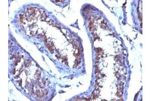 Image no. 1 for anti-Testosterone antibody (ABIN6189877) (Testosterone anticorps)