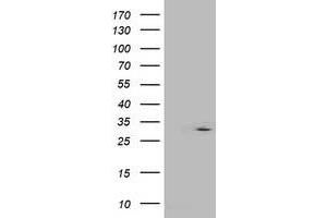 Western Blotting (WB) image for anti-Interferon-Induced Protein 35 (IFI35) antibody (ABIN1498801) (IFI35 anticorps)