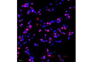 Immunofluorescence of paraffin embedded human lung using TFIIIC110 (ABIN7074038) at dilution of 1:650 (400x lens) (GTF3C2 anticorps)