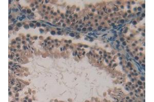 Used in DAB staining on fromalin fixed paraffin- embedded kidney tissue (LPO anticorps  (AA 305-498))