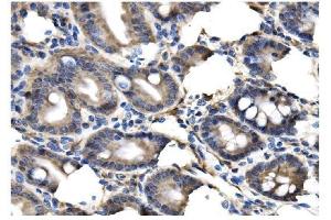 IHC analysis of Clathrin heavy chain/CLTC using anti-Clathrin heavy chain/CLTC antibody (ABIN7602704). (Clathrin Heavy Chain (CLTC) (AA 967-1668) anticorps)
