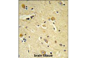 Formalin-fixed and paraffin-embedded human brain tissue reacted with CDIPT Antibody , which was peroxidase-conjugated to the secondary antibody, followed by DAB staining.