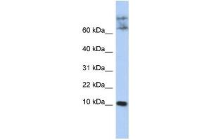 Western Blotting (WB) image for anti-Chemokine-Like Factor (CKLF) antibody (ABIN2459148) (CKLF anticorps)