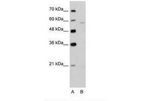 Image no. 2 for anti-Solute Carrier Family 22 (Organic Cation Transporter), Member 7 (SLC22A7) (AA 51-100) antibody (ABIN203433)