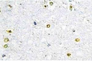 Immunohistochemistry (IHC) analyzes of TIF1alpha antibody in paraffin-embedded human brain tissue. (TRIM24 anticorps)