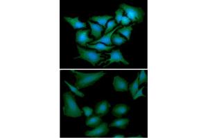 ICC/IF analysis of DNAL1 in HeLa cells line, stained with DAPI (Blue) for nucleus staining and monoclonal anti-human DNAL1 antibody (1:100) with goat anti-mouse IgG-Alexa fluor 488 conjugate (Green).
