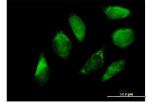 Immunofluorescence of purified MaxPab antibody to SERPINH1 on HeLa cell. (SERPINH1 anticorps  (AA 1-418))