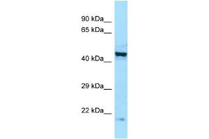 WB Suggested Anti-EIF2B2 Antibody Titration: 1. (EIF2B2 anticorps  (Middle Region))