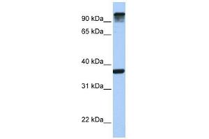 EPS15 antibody used at 1 ug/ml to detect target protein.