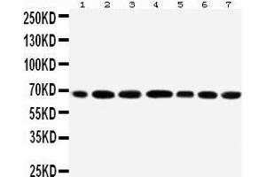 Anti-DDX5 antibody, Western blotting All lanes: Anti DDX5  at 0. (DDX5 anticorps  (C-Term))