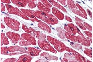 Human Heart (formalin-fixed, paraffin-embedded) stained with AOF2 antibody ABIN290327 at 5 ug/ml followed by biotinylated goat anti-rabbit IgG secondary antibody ABIN481713, alkaline phosphatase-streptavidin and chromogen. (LSD1 anticorps  (AA 100-150))