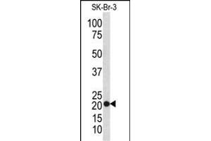 Western blot analysis of TAGLN antibody (N-term) (ABIN390626 and ABIN2840931) in SK-Br-3 cell line lysates (35 μg/lane).
