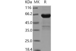 Western Blotting (WB) image for Fc Fragment of IgE, Low Affinity II, Receptor For (CD23) (FCER2) protein (Fc Tag) (ABIN7195671)