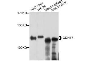 Western blot analysis of extracts of various cell lines, using CDH17 antibody (ABIN5975035) at 1:3000 dilution. (LI Cadherin anticorps)