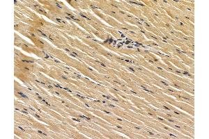 ABIN7096154 and ABIN7100216 at 1/100 staining rat muscle tissue by IHC-P. (GDPD3 anticorps)