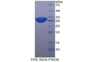 SDS-PAGE analysis of Human Sequestosome 1 Protein. (SQSTM1 Protéine)