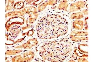 IHC image of ABIN7161797 diluted at 1:400 and staining in paraffin-embedded human kidney tissue performed on a Leica BondTM system.