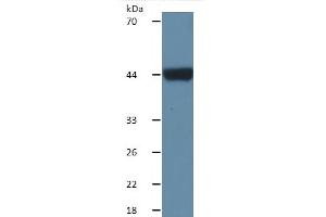 Mouse Capture antibody from the kit in WB with Positive Control: Sample Human serum.