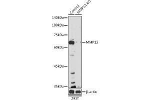 Western blot analysis of extracts from normal (control) and MMP13 knockout (KO) 293T cells, using MMP13 antibody (ABIN7268418) at 1:1000 dilution. (MMP13 anticorps  (AA 262-471))