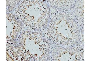 IHC analysis of DDX4/MVH using anti-DDX4/MVH antibody (ABIN7601204). (DDX4 anticorps  (AA 3-666))