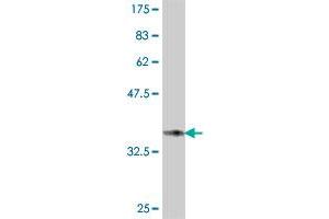 Western Blot detection against Immunogen (37.