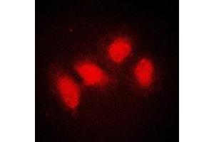 Immunofluorescent analysis of SMG7 staining in A431 cells. (SMG7 anticorps  (Center))