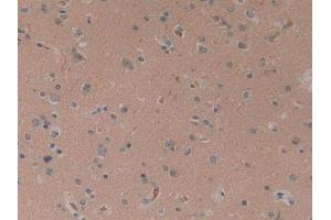 IHC-P analysis of Human Brain Tissue, with DAB staining. (CYLD anticorps  (AA 170-338))