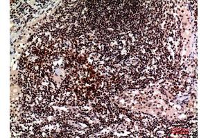 Immunohistochemistry (IHC) analysis of paraffin-embedded Human Lymph, antibody was diluted at 1:100. (2B4 anticorps  (Internal Region))