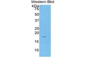 WB of Protein Standard: different control antibodies against Highly purified E. (Haptoglobin Kit CLIA)
