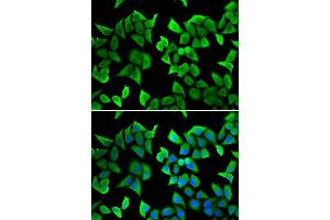 Immunofluorescence analysis of MCF7 cell using AKT1 antibody. (AKT1 anticorps)