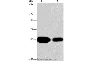 Western blot analysis of Human fetal brain and mouse brain tissue, using APBA1 Polyclonal Antibody at dilution of 1:200