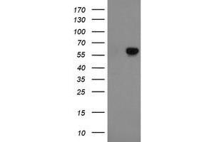 Western Blotting (WB) image for anti-Formiminotransferase Cyclodeaminase (FTCD) antibody (ABIN1496378)