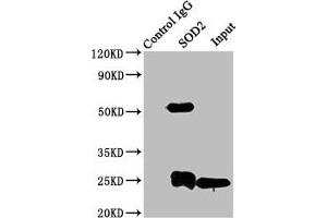 Immunoprecipitating SOD2 in K562 whole cell lysate Lane 1: Rabbit control IgG instead of ABIN7170983 in K562 whole cell lysate.
