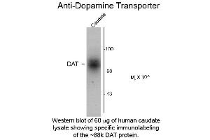 Western blot of Dopamine Transporter C-Terminus Human Antibody Western Blot of Rabbit Anti-Dopamine Transporter C-Terminus Human Antibody.