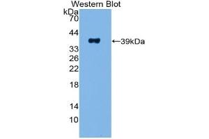 Detection of Recombinant PP, Human using Polyclonal Antibody to Pancreatic Polypeptide (PP) (PPY anticorps  (AA 30-87))